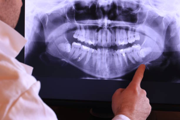 Best Emergency Dental Extractions in Benwood, WV